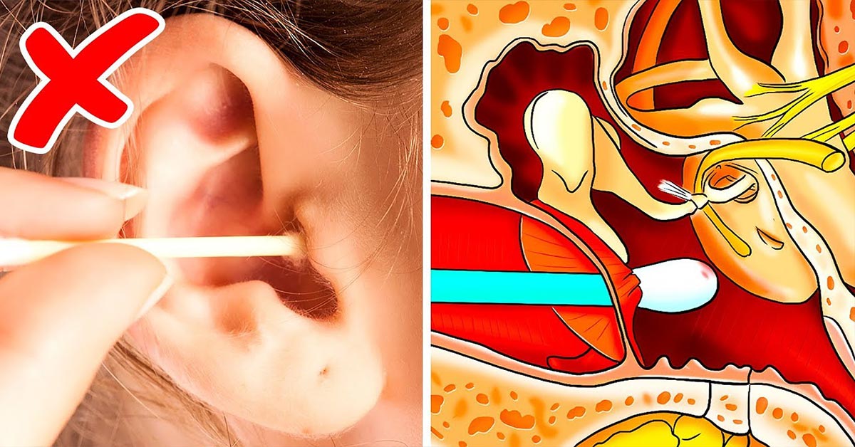 15 Effective Home Remes To Remove Ear Wax Safely