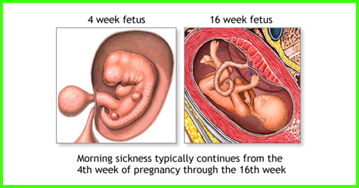 15 Effective Home Remedies To Stop Vomiting During Pregnancy