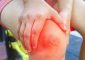 Home Remedies For Cellulitis - How To...