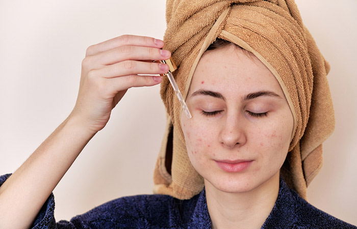 Woman using camphor oil for acne