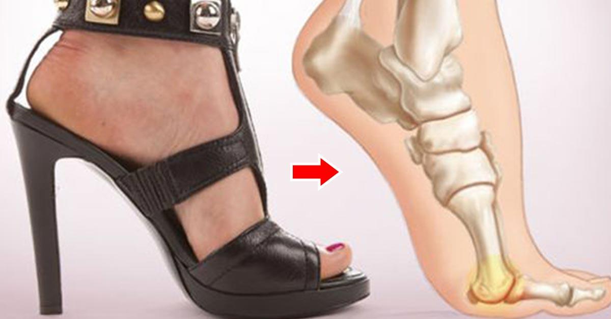 10 Side Effects Of Wearing High Heels