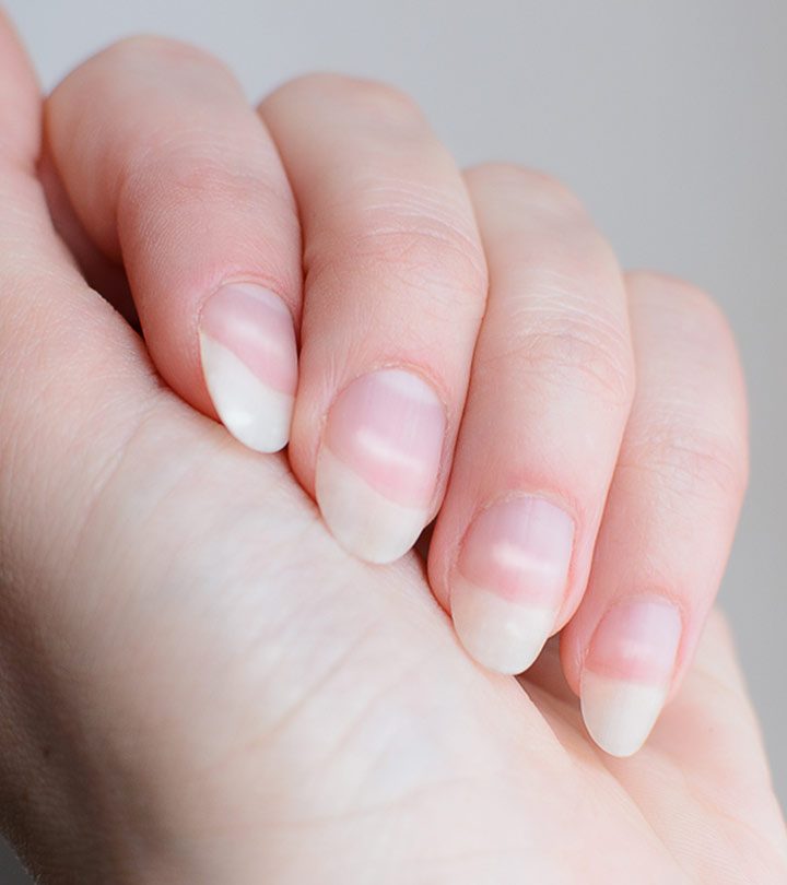 White Spots On The Fingernails – Causes And Treatment