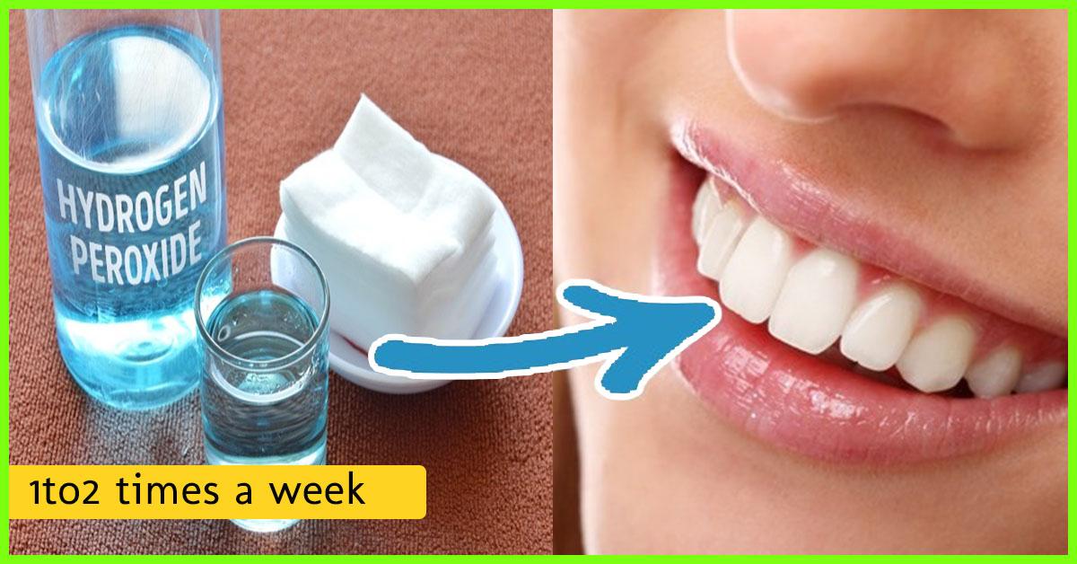 teeth whitening home remedies baking soda hydrogen peroxide