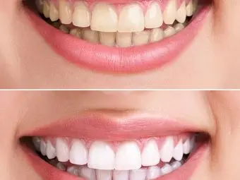 Hydrogen Peroxide For Teeth Whitening - 6 Home Remedies