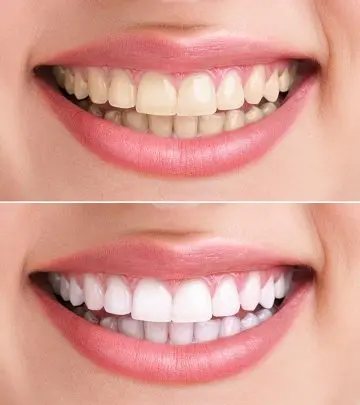 Hydrogen Peroxide For Teeth Whitening – 6 Home Remedies To Whiten Teeth