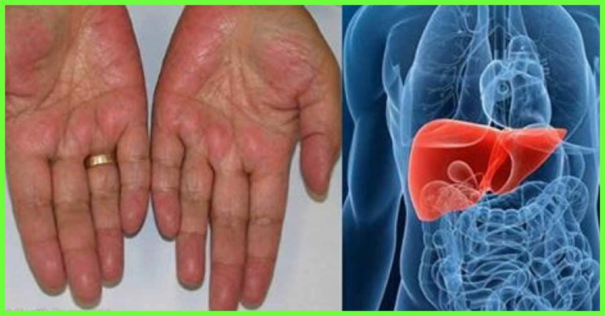 water fasting before and after 7 days