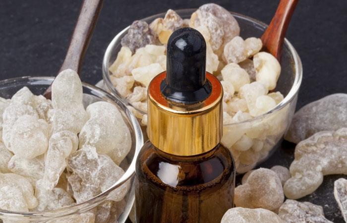  13. Frankincense Oil