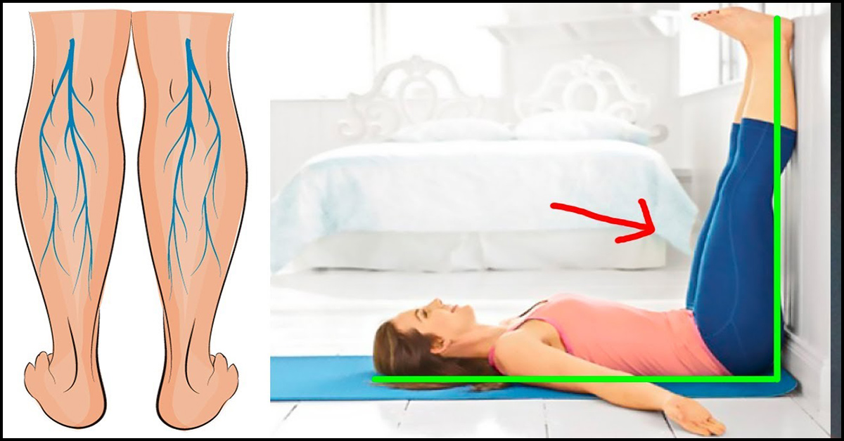 yoga în assana varicose varicoza i ceasuri pe picioare