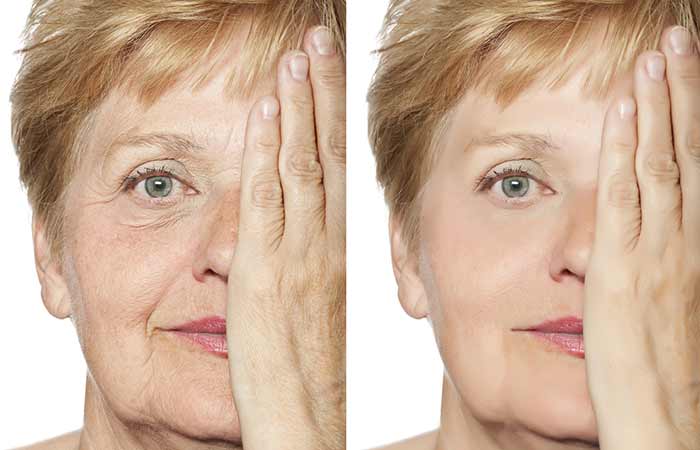 Castor oil to reduces wrinkles around the eyes
