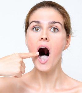 14 Home Remedies For White Tongue And Pre...