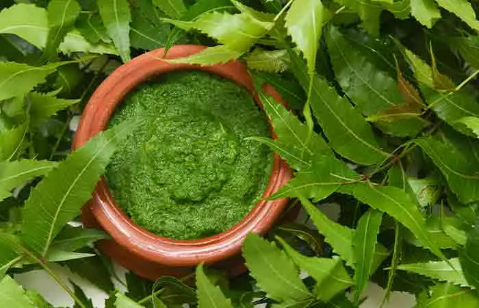 Neem as a remedy for tinea versicolor