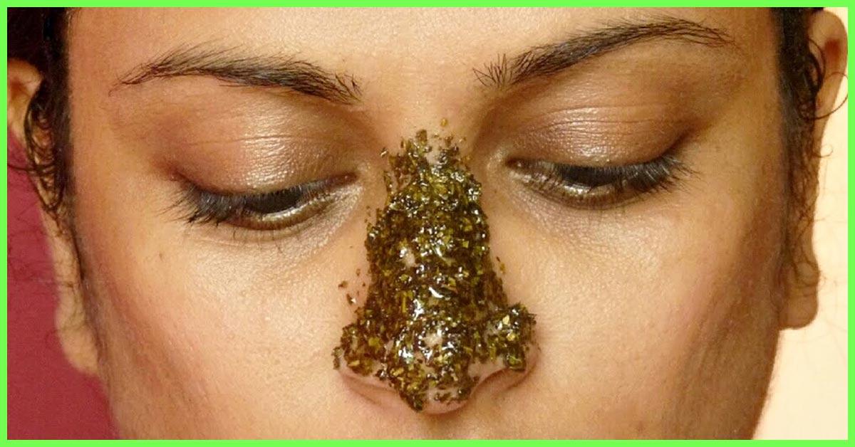 how to remove blackheads