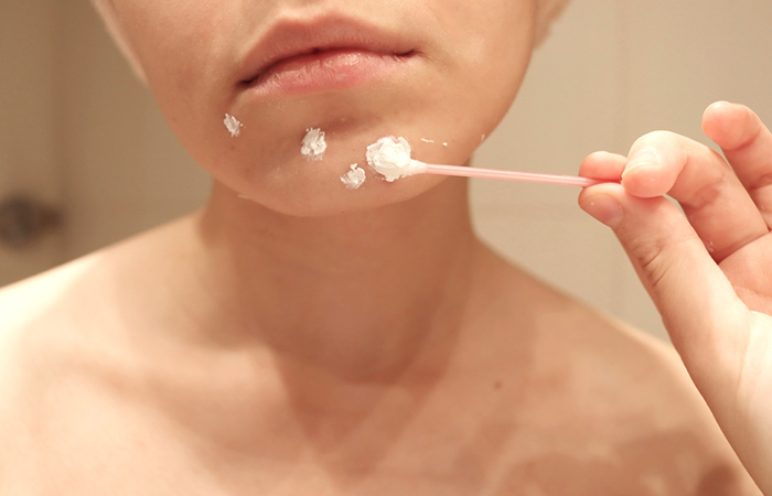 Close up of a woman applying aspirin paste on her acne.