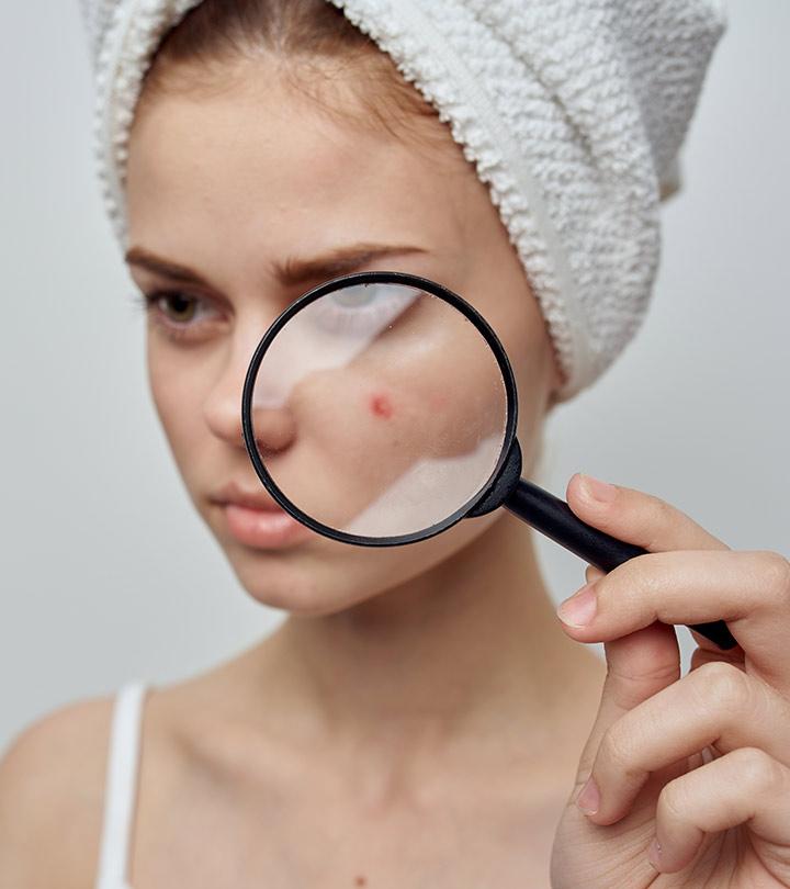 Vitamin E for Acne: Does It Work, Risks, and More