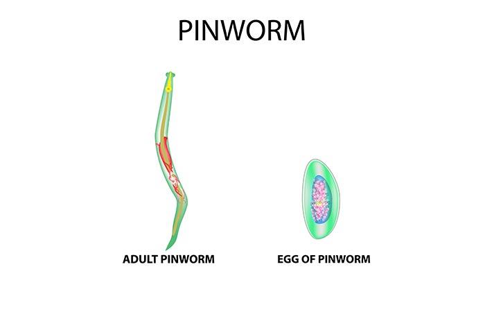 Pinworm tojások, milyen méretű néz ki. Pinworms felnőtt képekben Calaisban