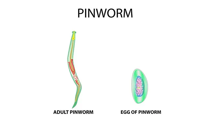 What are pinworms
