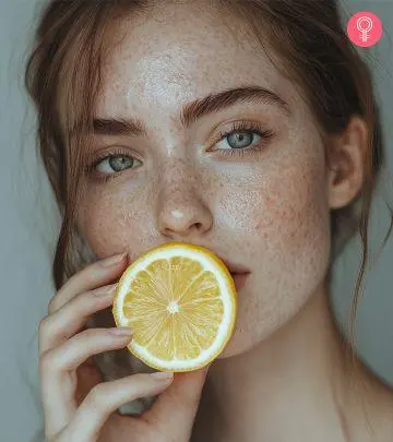 Women Suffering From Dark Spots Treating With Lemon Juice