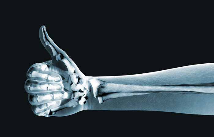 X-ray hand on black background portraying good bone health