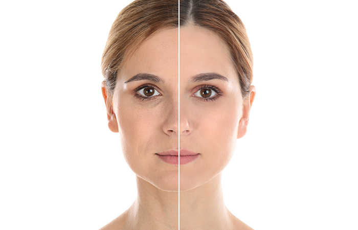 The difference between aging skin and youthful skin