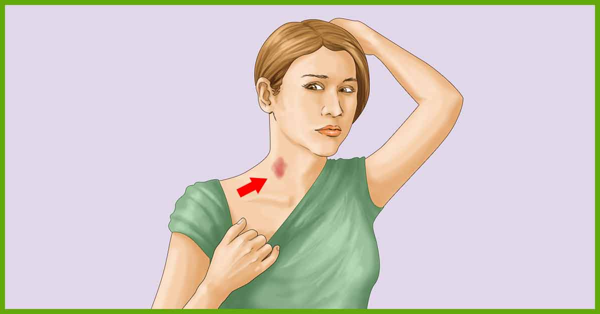 Yourself to a with a your hickey give spoon on neck How To