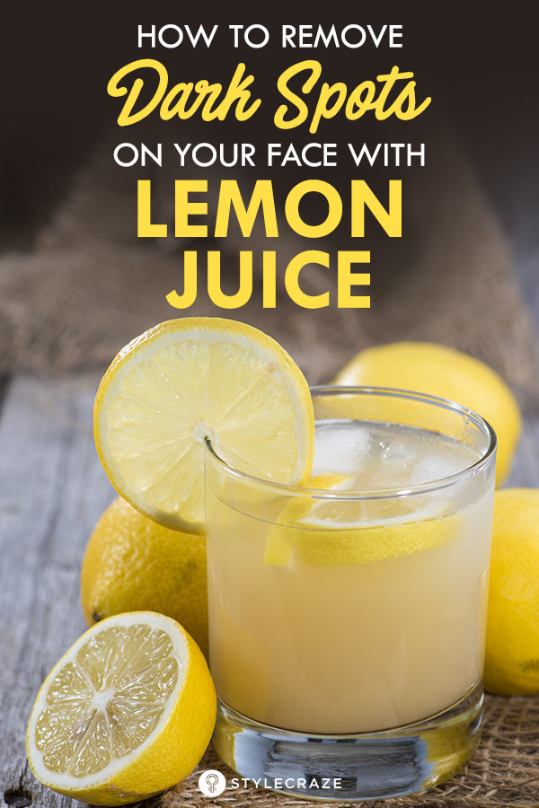 Lemon Juice For Dark Spots On Face