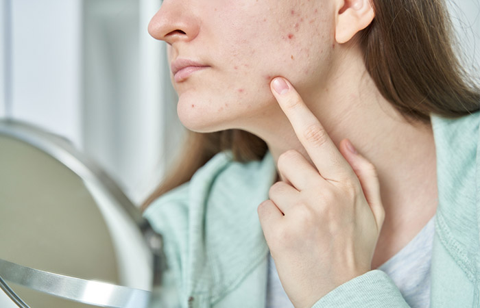 Woman with pigmentation