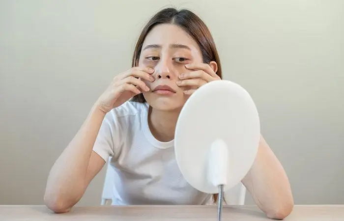 Your dark circles are getting worse! You must try this face pack