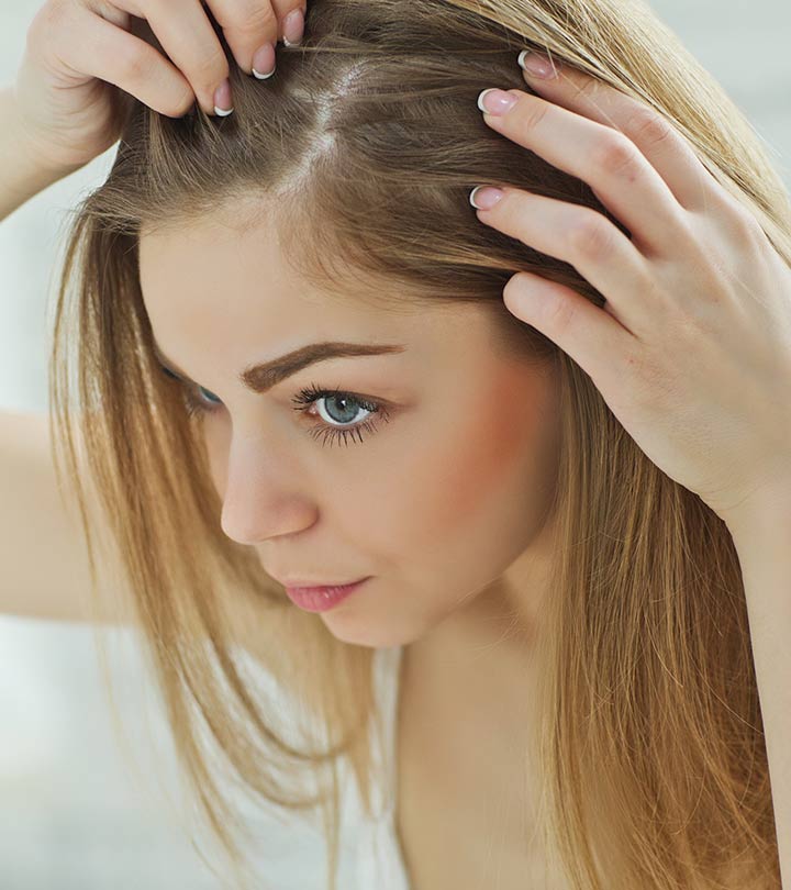 Lesser Known Home Remedies To Get Rid Of Dandruff