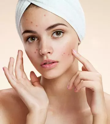 5 Videos Featuring Home Remedies For Everyday Skin Problems