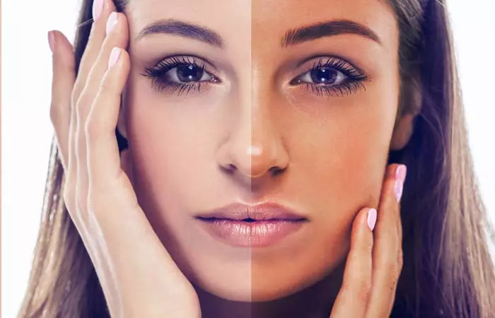2.-Cornstarch-To-Get-Rid-Of-Sun-Tan