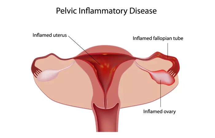 6-Reasons-Your-Vagina-Hurts