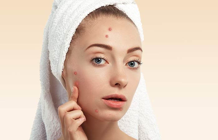 It-Can-Be-Used-To-Treat-Pimples-And-Acne