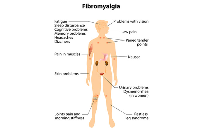 The Fibromyalgia Mystery Is Solved At Last