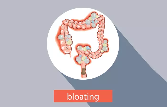 What-Causes-Bloating