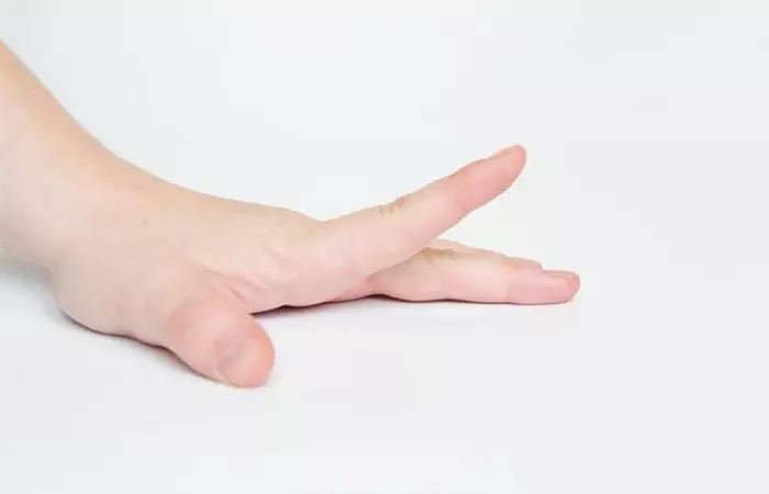 Wrap A Rubber Band Around Your Fingers To Keep The Pain And Stiffness Away5