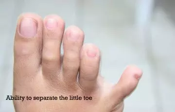 Ability-to-separate-the-little-toe