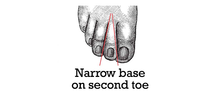 Narrow-base-on-second-toe
