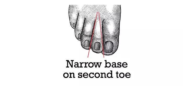 Base étroite sur le deuxième orteil