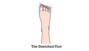 The-Stretched-Foot