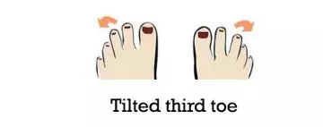 Tilted-third-toe