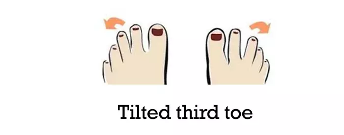 Slanted third toe