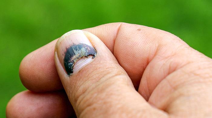 10. Loose Nails