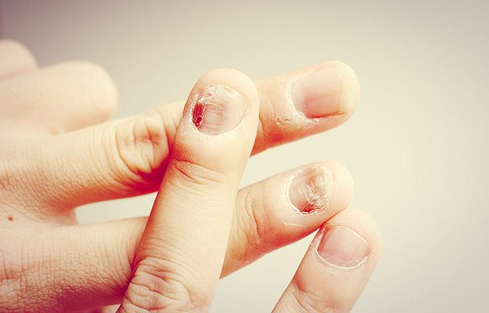 9. Red Nails
