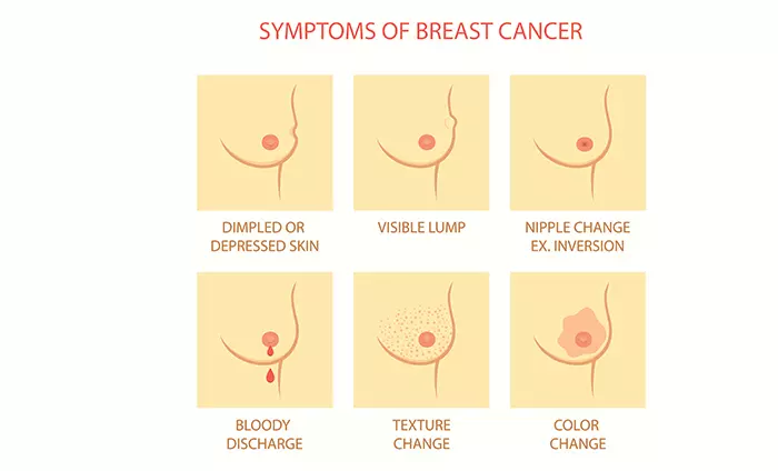 signs of breast cancer that have nothing to do with a lump