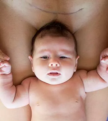 3 Truths About C-Section Mothers That Everyone Should Know