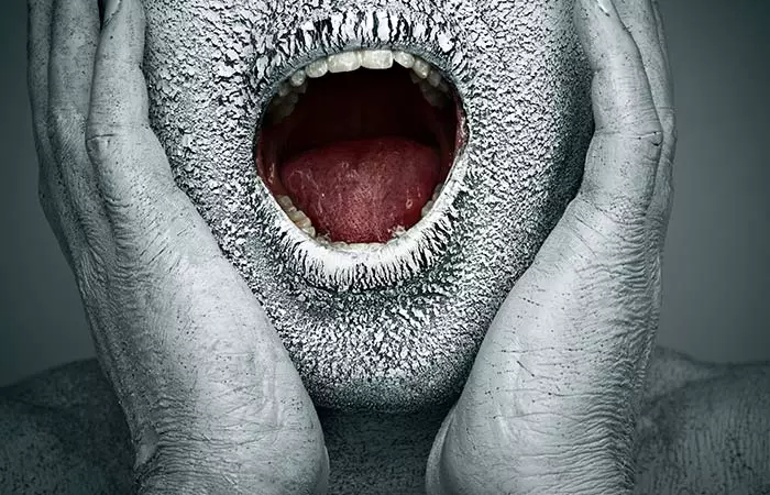 4. Level Of Dehydration