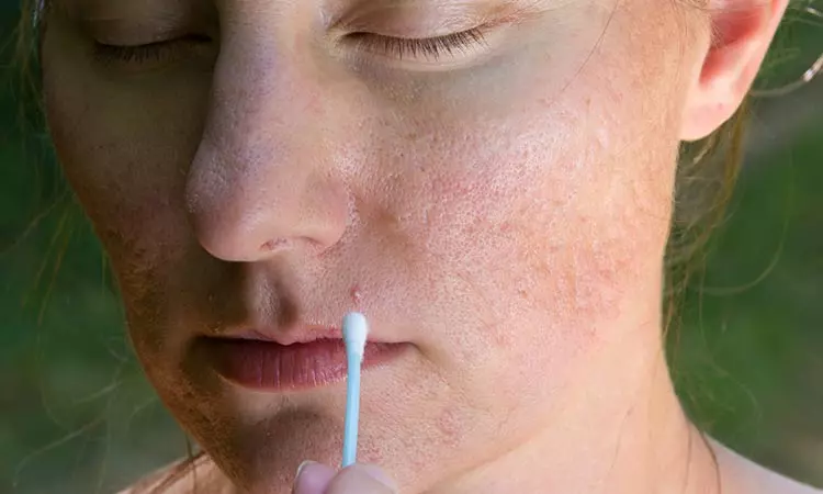 4. Pore Of The Issue