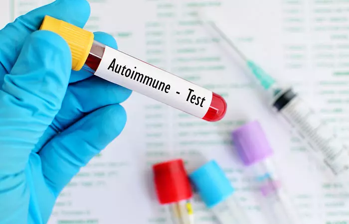 2. Autoimmune Diseases