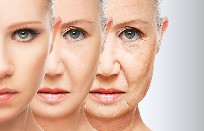 3. Aging