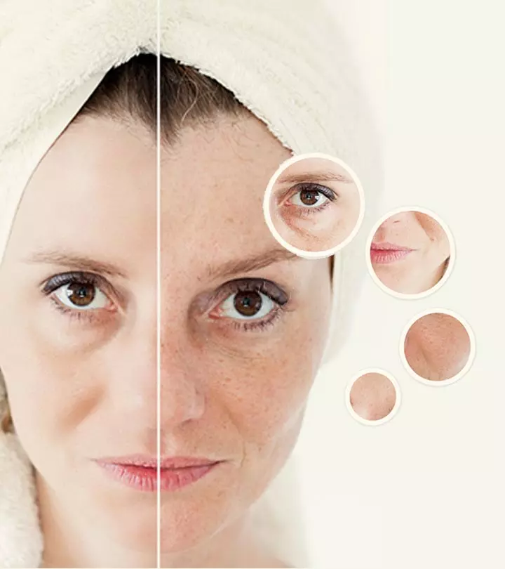 How-To-Get-Rid-Of-Large-Pores.-Your-Decision-Depends-On-Your-Age